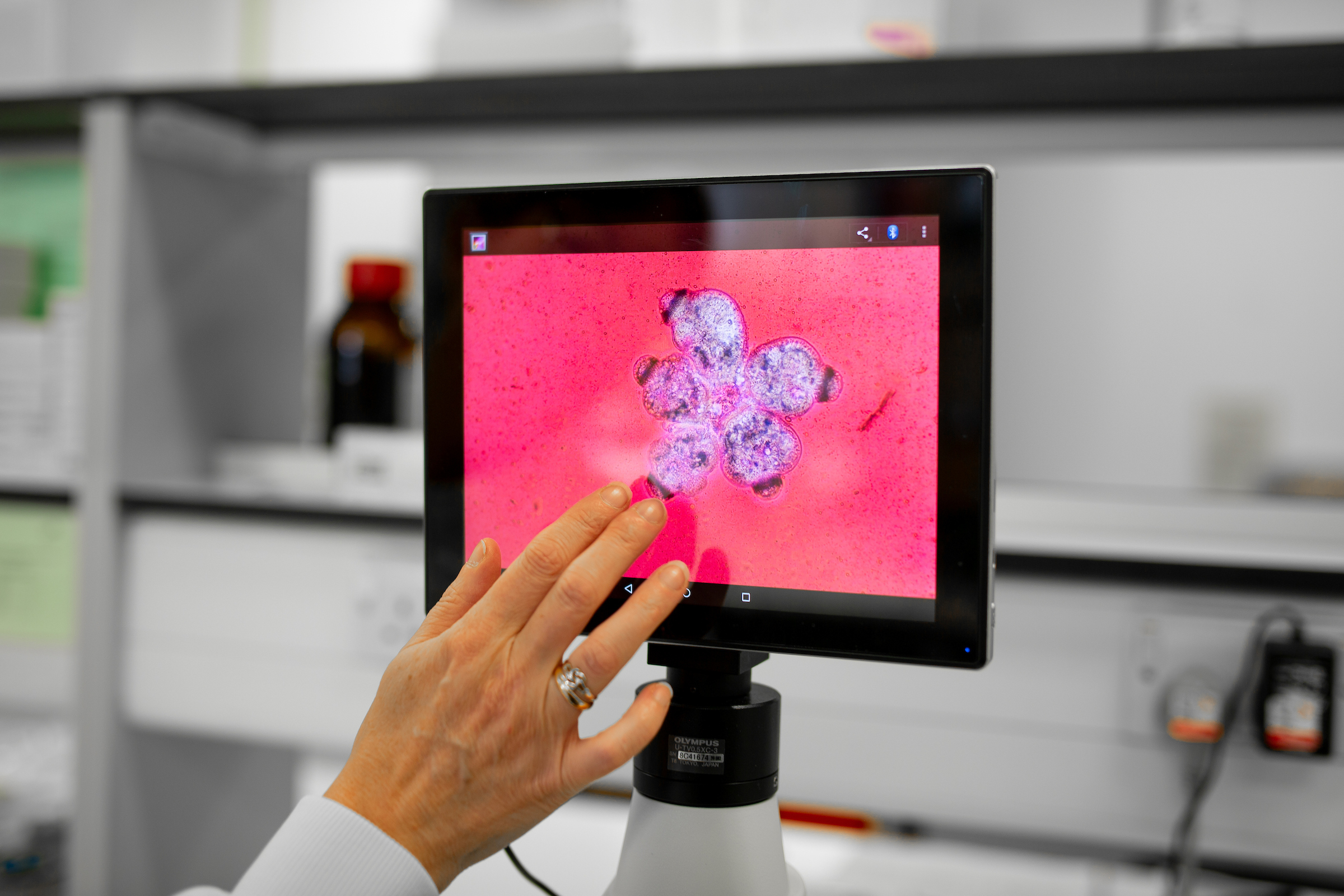 A researcher’s hand touches a digital microscope screen displaying a magnified image of cells under pink illumination in a laboratory setting.