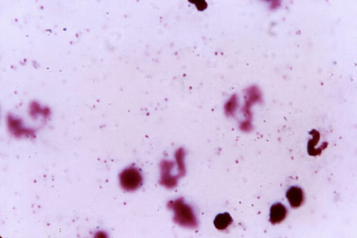 plasmodium falciparum