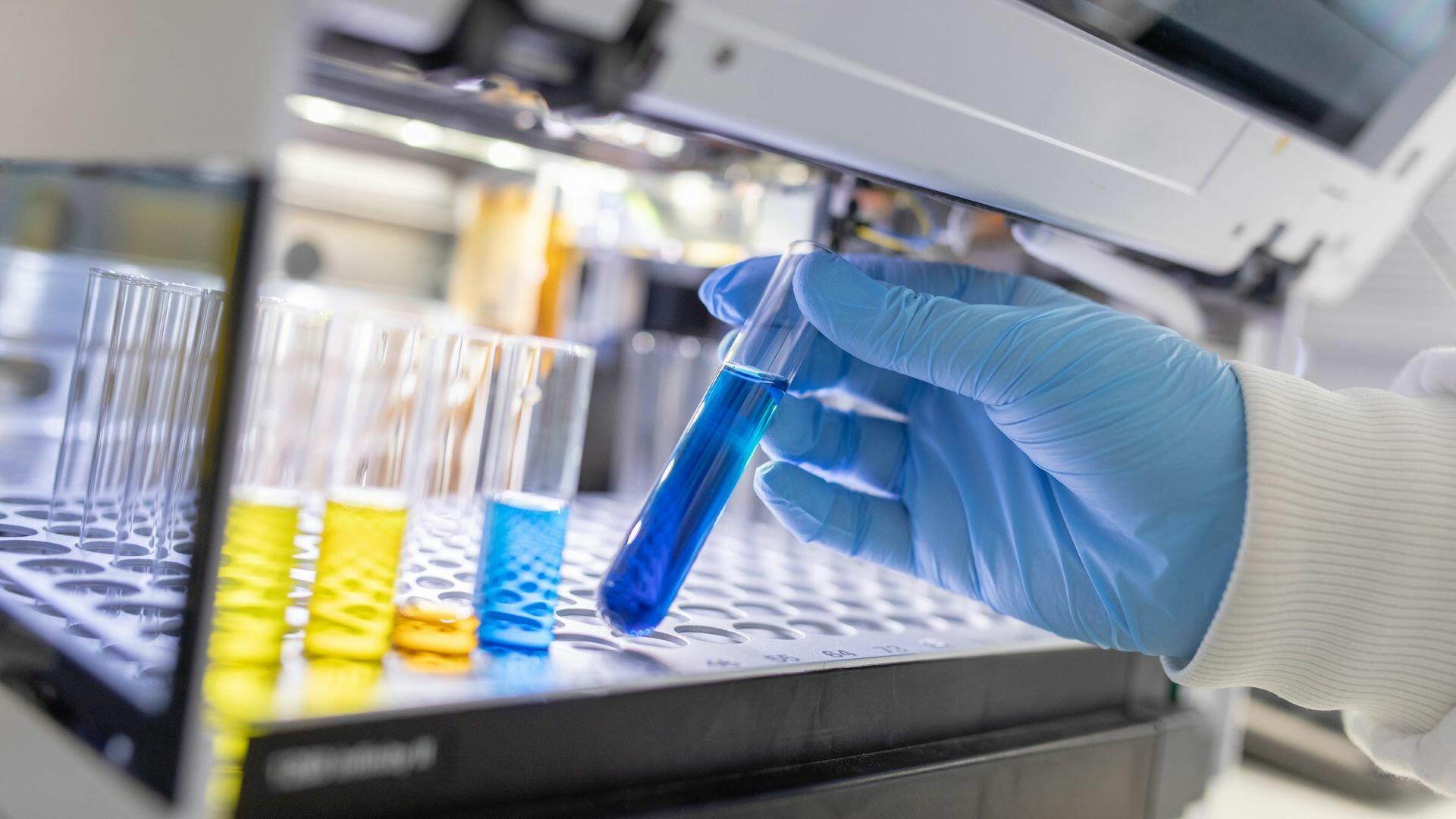 Photo of test tube samples in a lab.