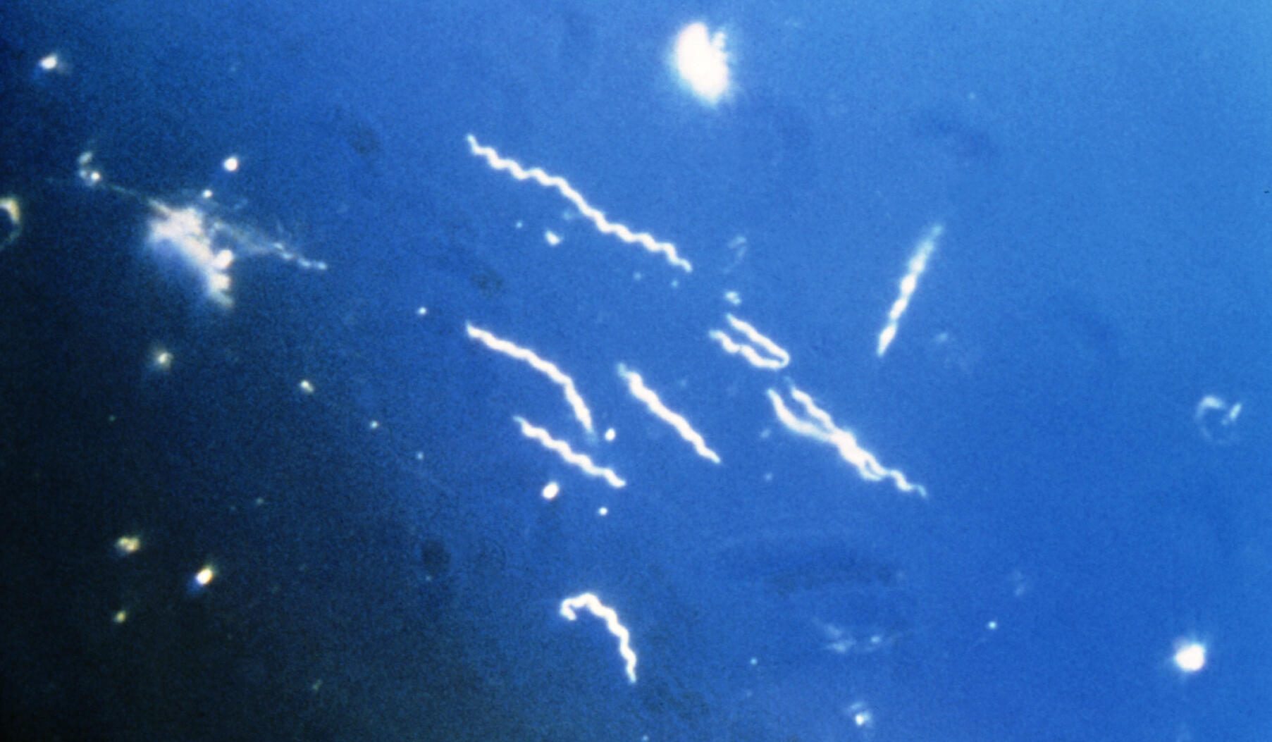 Microscopic image showing spiral-shaped Borrelia bacteria under dark-field illumination. The bright, corkscrew-like organisms stand out against a dark blue background, characteristic of spirochete bacteria associated with Lyme disease and relapsing fever.