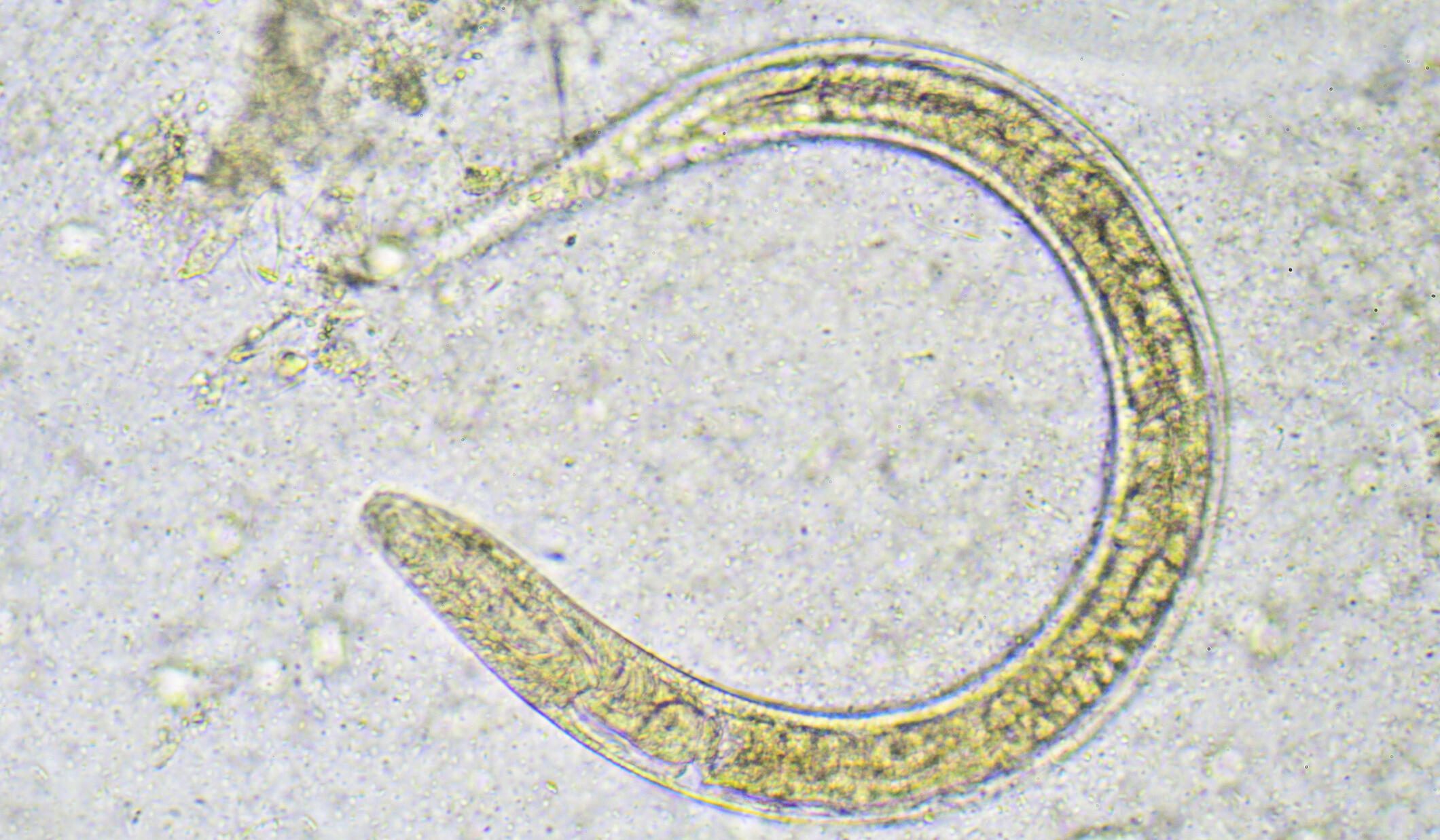 Microscopic image showing a Strongyloides stercoralis larva. The translucent, elongated parasitic worm has a curved body with visible internal structures, seen against a light background under high magnification.