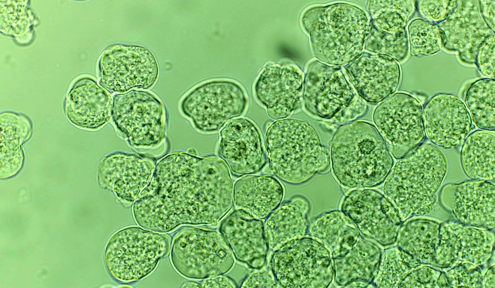 Microscopic image showing clusters of Entamoeba histolytica trophozoites. The round, translucent protozoa with granular interiors are visible against a green-tinted background, representing the parasite responsible for amoebic dysentery.