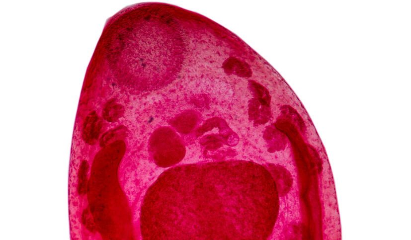 Microscopic image of an intestinal trematode (fluke) stained pink to highlight internal structures. The flat, oval-shaped parasitic worm shows visible internal organs and reproductive structures, characteristic of flukes that infect the human intestine.