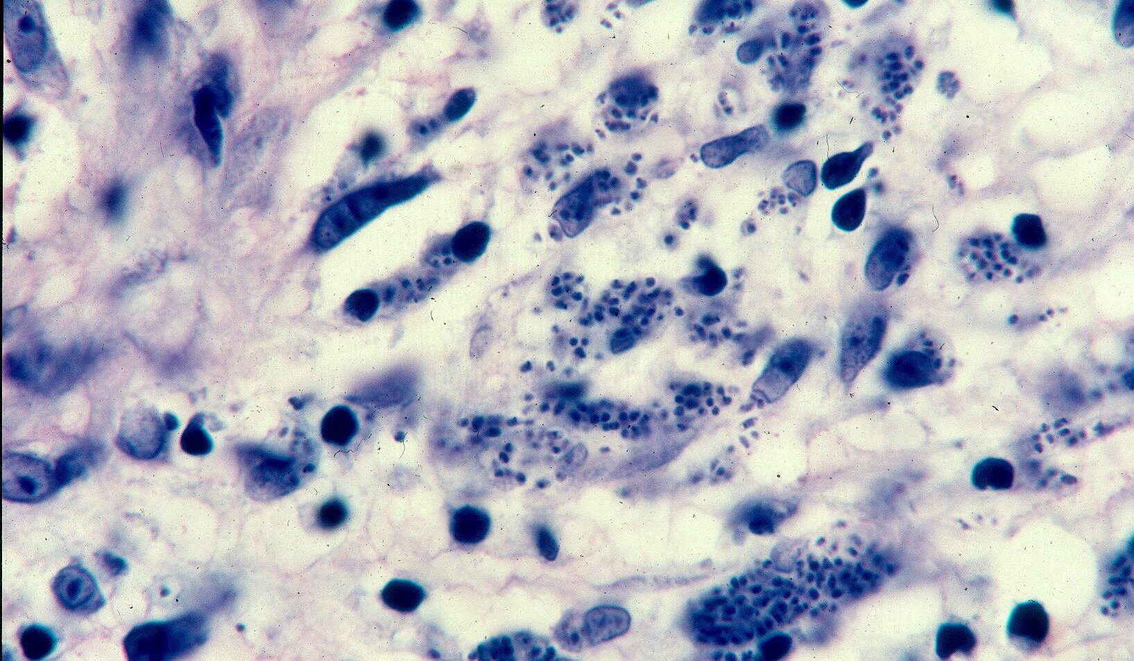 Microscopic image of tissue infected with Toxoplasma gondii. Numerous crescent-shaped tachyzoites are visible within cells, stained in shades of blue and purple, showing the clustered arrangement typical of toxoplasmosis infection.