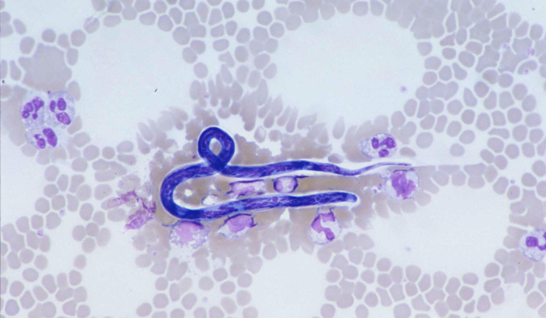 Microscopic image showing a stained microfilaria among red and white blood cells. The slender, thread-like parasitic worm is coiled and vividly stained blue, characteristic of filarial infections transmitted by mosquitoes.