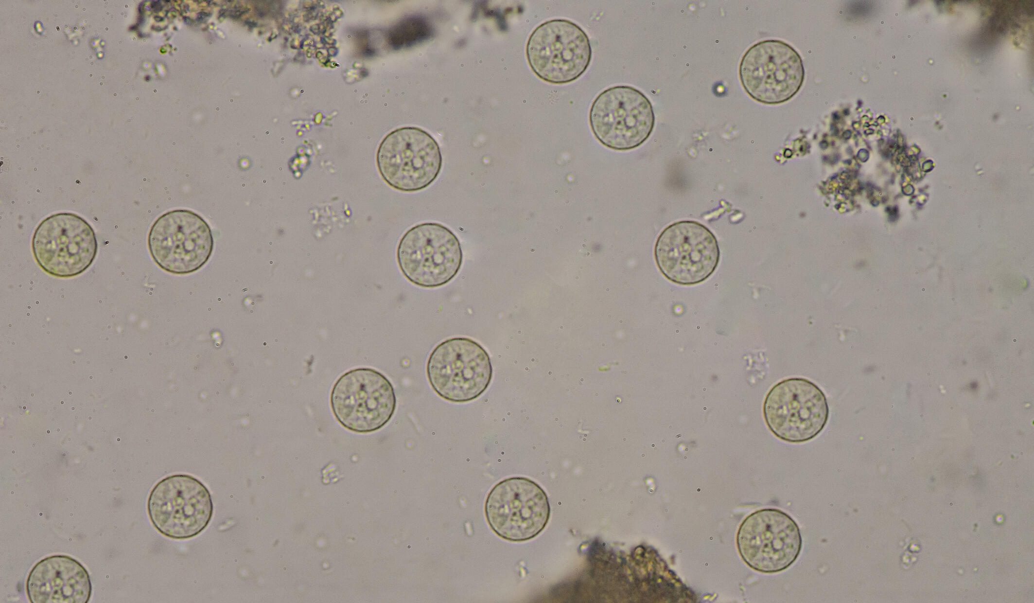 Microscopic image showing cysts of Entamoeba histolytica in a stool sample. The round, transparent cysts with visible nuclei are evenly distributed across the light background, characteristic of amoebiasis infection.