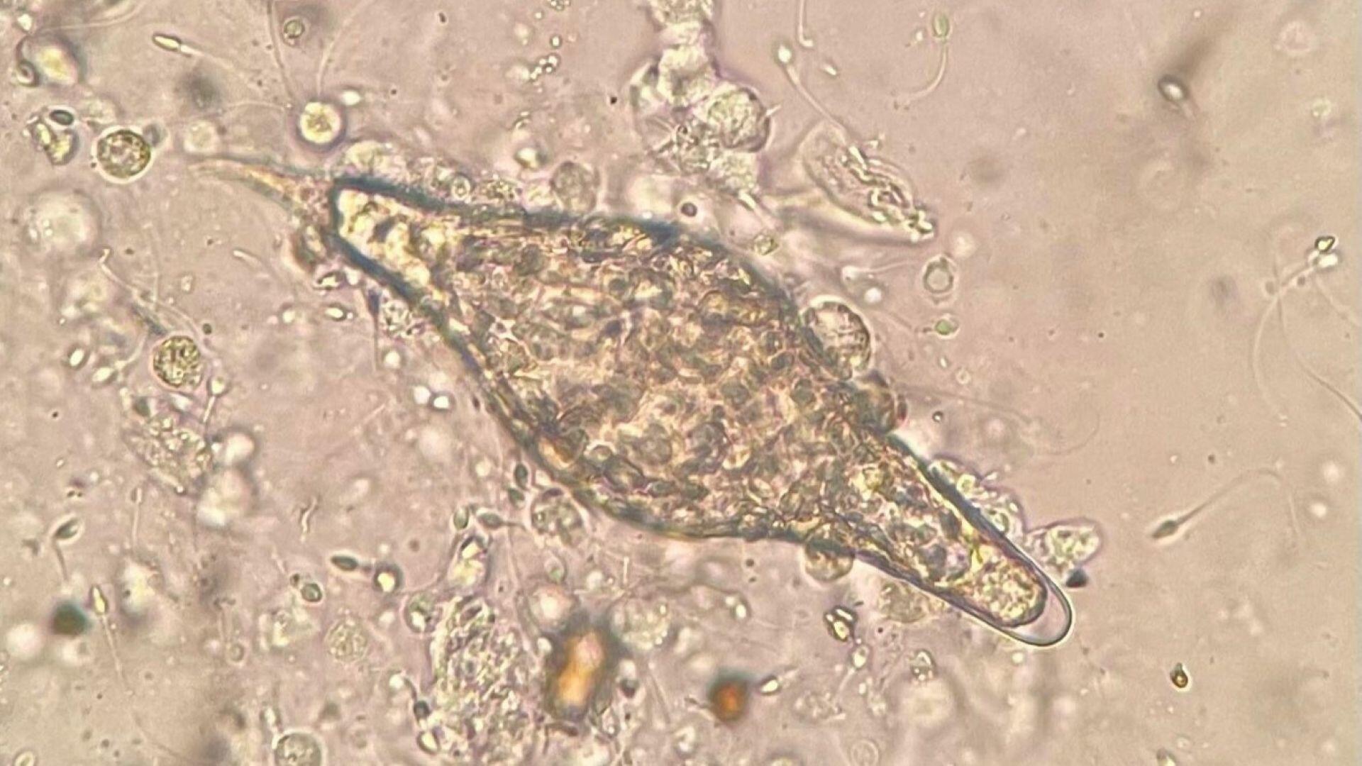 Microscope image of an elongated, translucent microorganism with tapered ends, surrounded by fluid and small particles.