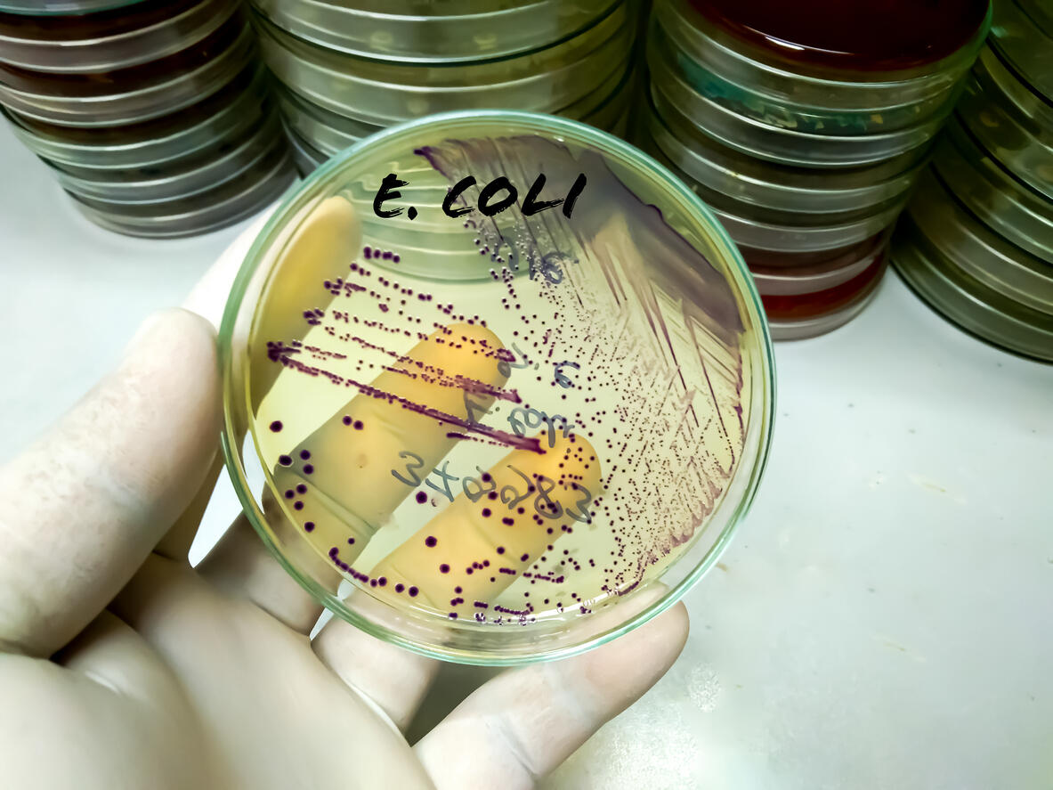 Gloved hand holding a Petri dish labelled “E. coli”, showing purple bacterial colonies on agar, with stacks of culture plates in the background.