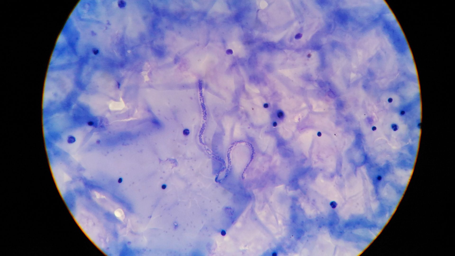 A picture of a worm under a microscope.