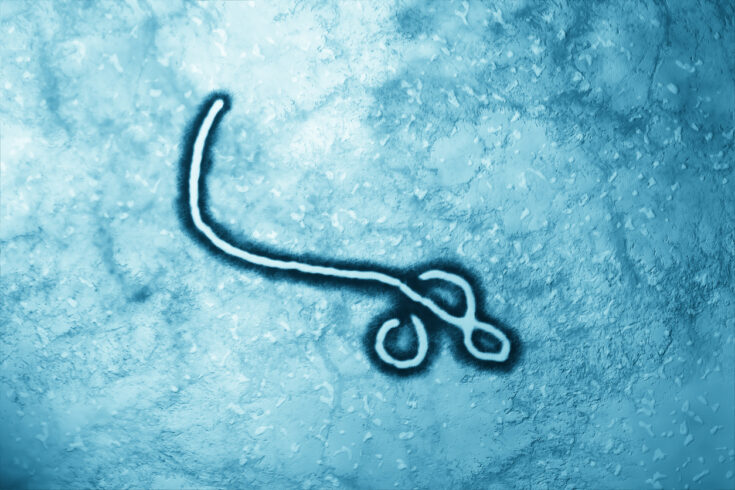 Microscopic view of Ebola Virus