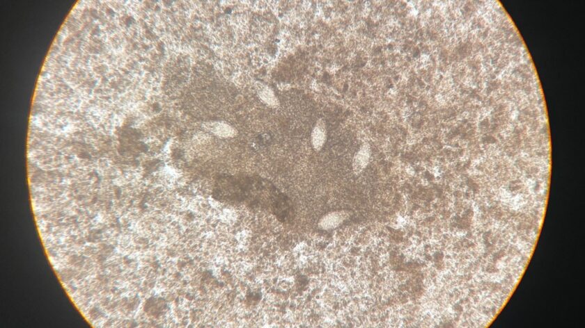 A photo of schistosomes in a human female egg under a microscope.